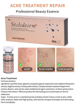 OEM ODM Stalidearm Anti Akne Serum Bitkisel Tedavi Cilt Onarım Bakım Çözümü Anti Akne Pimple Scar Remover Yüz Serumu