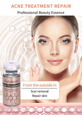 OEM ODM Stalidearm Anti Akne Serum Bitkisel Tedavi Cilt Onarım Bakım Çözümü Anti Akne Pimple Scar Remover Yüz Serumu