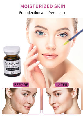 OEM ODM Stalidearm Deri Bakım Ürünü Hyaluronik Asit Dolgu Anti kırışıklık Anti Yaşlanma Yüz Mesoterapi Serum Enjeksiyon