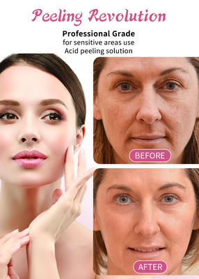 30ml Cilt Peeling Serumu / Profesyonel Sınıflı Sıvı Yüz Cilt Peeling Çözümü
