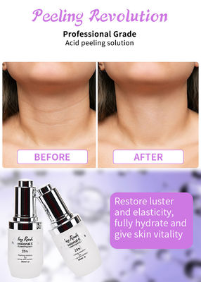 Profesyonel Kalite Yüz Peeling Serumu, Deri Peeling Çözümü için