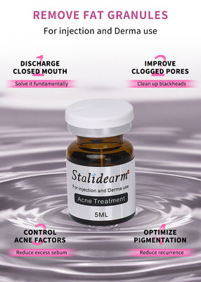 Stalidearm Dermal Fillers Akne Tedavisi Akne İyileşmesi ve Lekeler Azaltması için Enjeksiyon Serumu