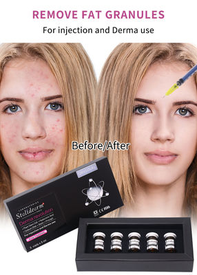 Stalidearm Dermal Fillers Akne Tedavisi Akne İyileşmesi ve Lekeler Azaltması için Enjeksiyon Serumu