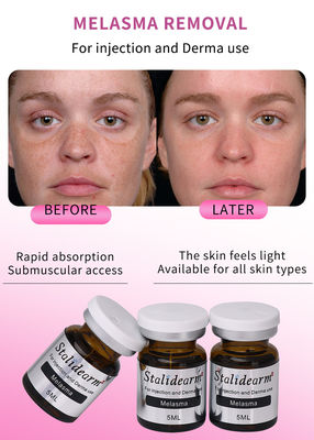 Stalidearm Dermal Fillers Freckle Yüz Cilt Bakımı Melasma Tedavisi