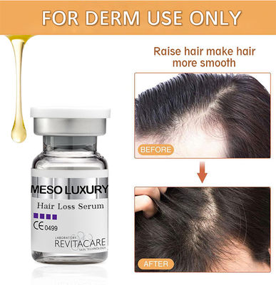 Bitkisel Doğal Saç Çıkan Serum Bakımı 10ml Özel Özel Etiket