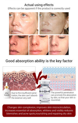 Aydınlatıcı Sıkılaştırıcı Meso Serum Microneedling Mezoterapi Havyar Özlü Serum