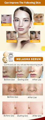 Cilt Bakımı Meso Serum Microneedling Kaldırma Çil Serumu Melazma Cilt Beyazlatma