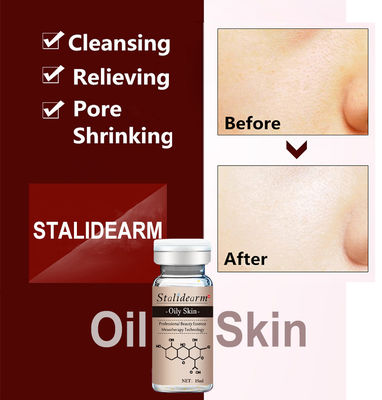 Yağlı Ciltler İçin Organik Bitkisel Serum Anti Akne Özelleştirilmiş Etiket Dermapen Yüz Özü