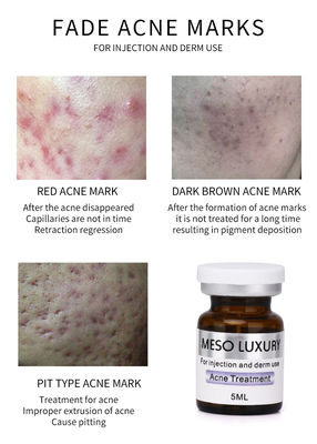 MESO LUXURY Enjeksiyon Mesoterapi Çözümü Ekzozomlar Serum Kırmızı Lekeler Cilt Akne Tedavisi
