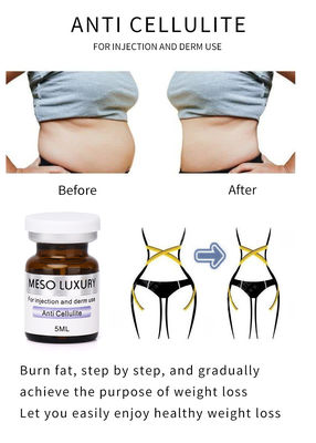 Selülit Karşıtı Mezoterapi Zayıflama Esansı Kilo Verme Göbek Yağı Yakma Ekzom Serum