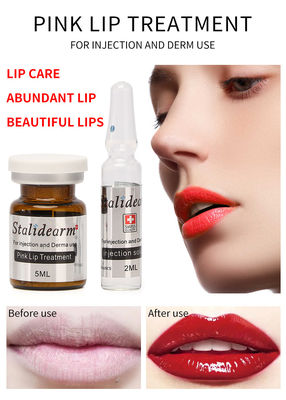 Ekzom Serum Mezoterapi Çözeltisi Pembe Dudak Tedavisi Enjekte Edilebilir Serum Dermal Dolgu