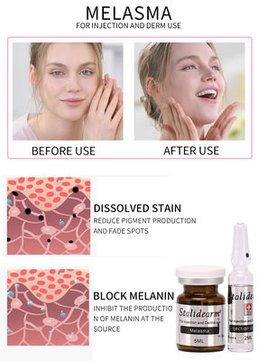 Melazma Enjeksiyon Serum Kullanımı Güvenli ve İyi Etki Mezoterapi 5ml/şişe serum seti