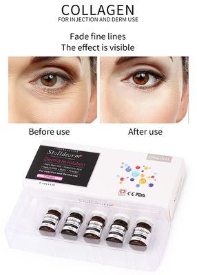 Enjekte edilebilir Kolajen Mezoterapi Çözümü Ekzozom Serum Set Cilt Güçlendirici
